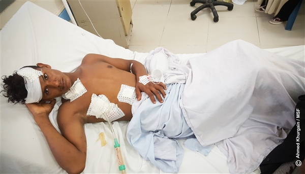 الحديدة : استشهاد وإصابة 22 مواطنا أغلبهم أطفال جراء قصف حوثي استهدف حيا سكنيا بالحديدة